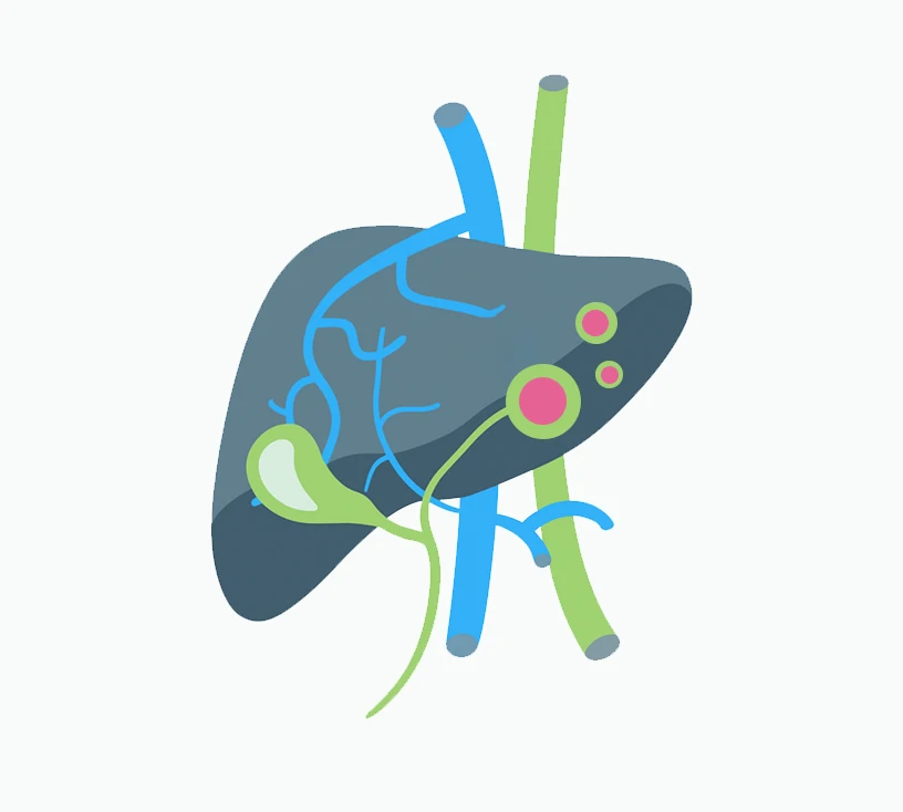 Liver tumors and metastases
