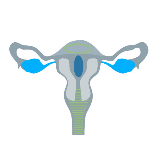 Tumores Ginecológicos