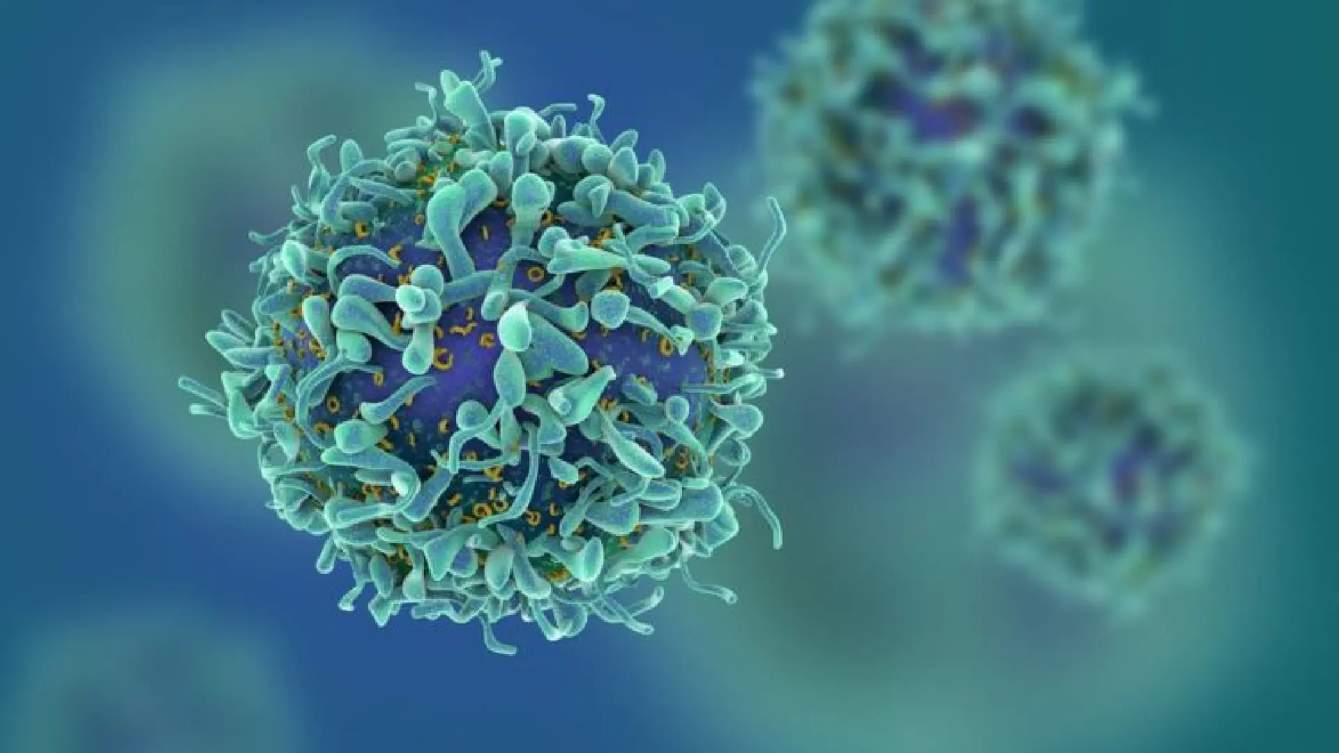 Cytoreductive Surgery in Cancer: What It Is and When It Is Used