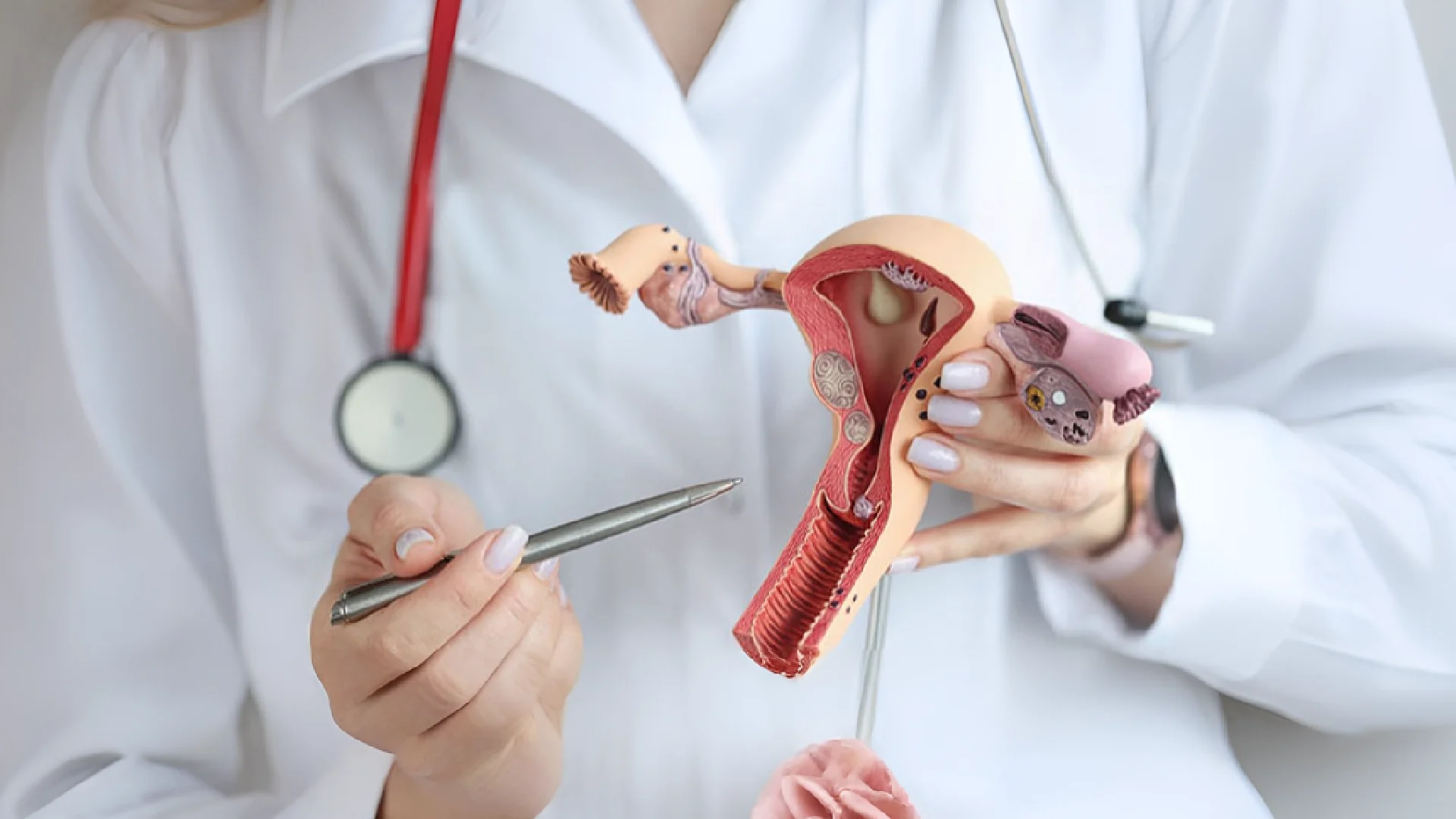 ¿Se puede vivir con cáncer de ovario? El papel clave de la cirugía en la supervivencia