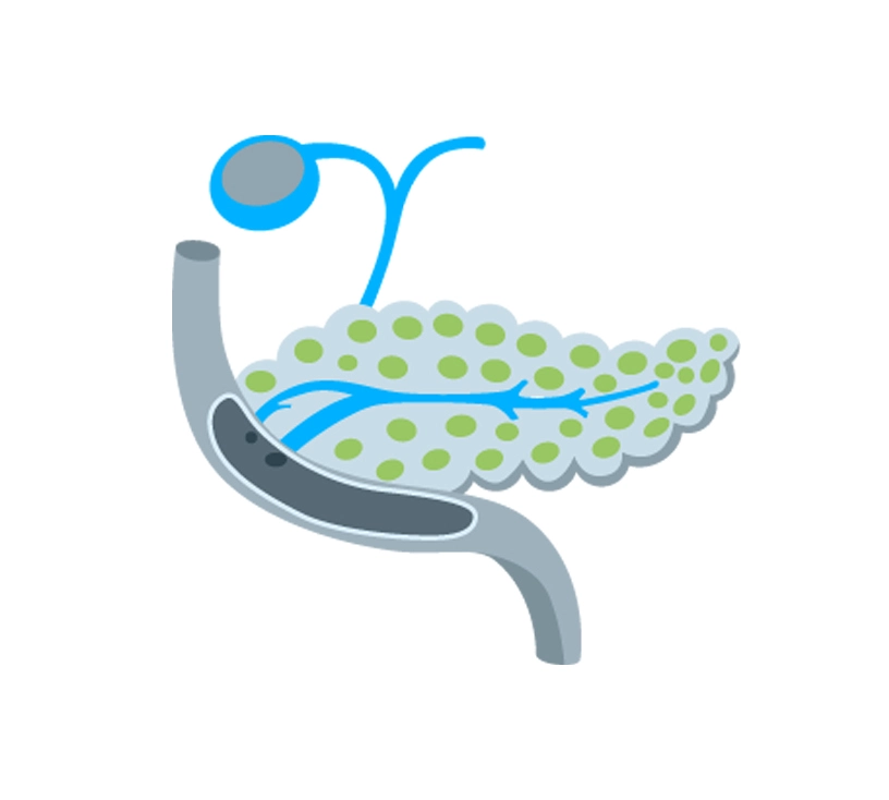Cáncer-de-páncreas